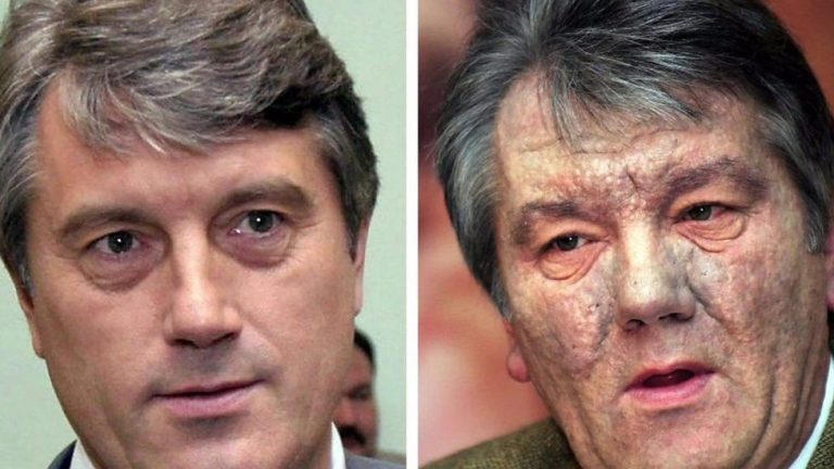 Yuşçenko’nun Zehirlenmesinde “İçeriden İhanet” Şüphesi: Oklar David Jvaniya’ya Dönüyor